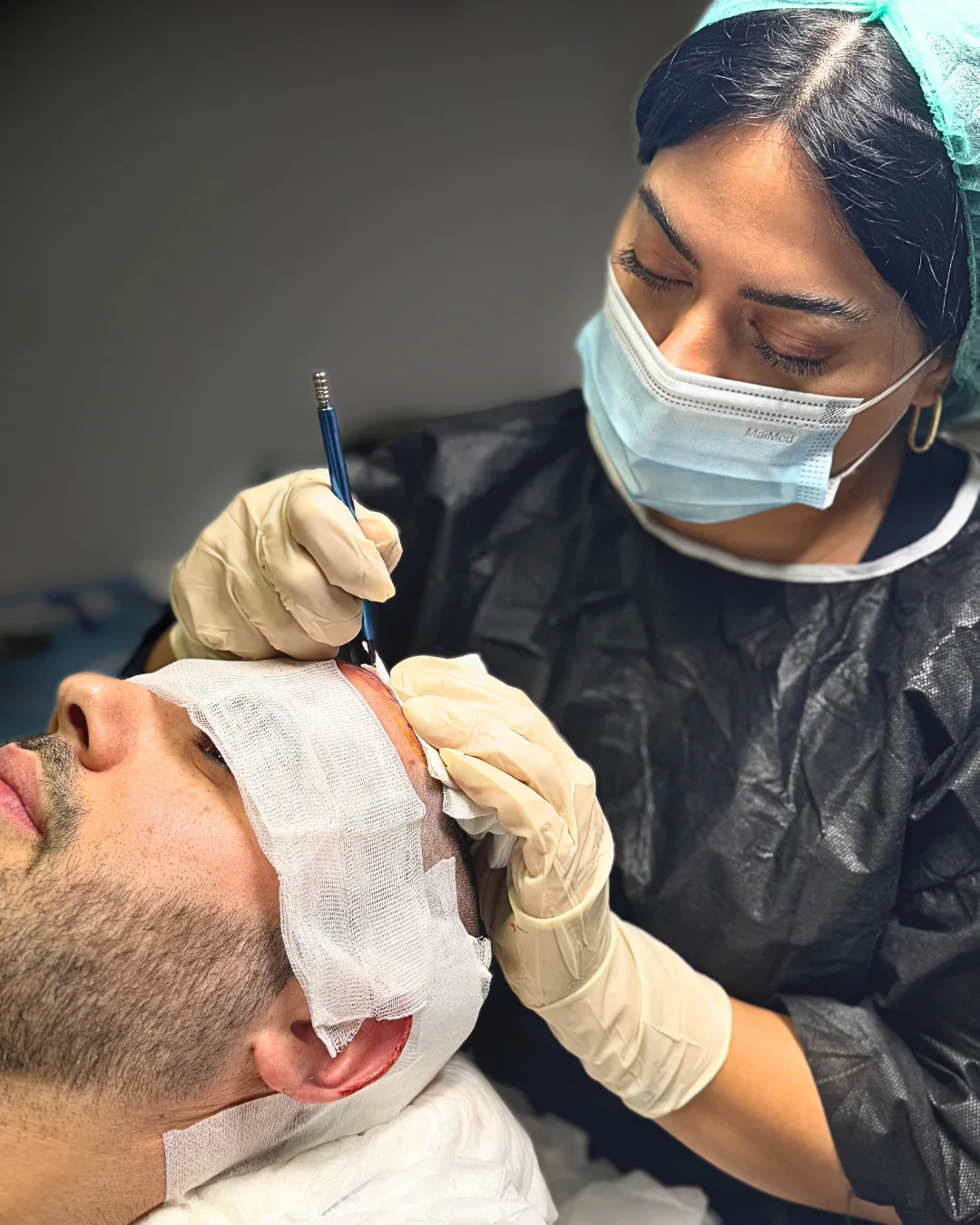 HM Hair Transplantation treatment